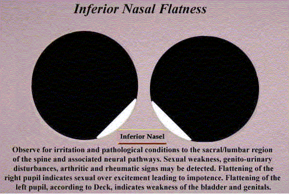 iriscopie irisdiagnosis